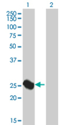 Lane 1: ARG1 transfected lysate (26.07 KDa). Lane 2: Non-transfected lysate.