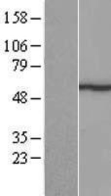 Western Blot: METTL14 Overexpression Lysate (Adult Normal) [NBL1-12275] Left-Empty vector transfected control cell lysate (HEK293 cell lysate); Right -Over-expression Lysate for METTL14.