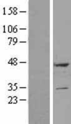 Western Blot: DULLARD Overexpression Lysate (Adult Normal) [NBP2-11067] Left-Empty vector transfected control cell lysate (HEK293 cell lysate); Right -Over-expression Lysate for DULLARD.