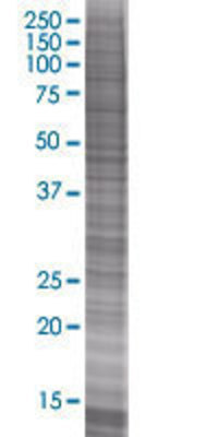 ARG1 transfected lysate