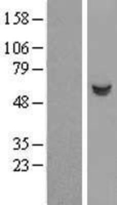 Western Blot: Salivary Amylase Alpha Overexpression Lysate (Adult Normal) [NBP2-10997] Left-Empty vector transfected control cell lysate (HEK293 cell lysate); Right -Over-expression Lysate for Salivary Amylase Alpha.