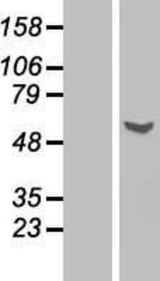 Western Blot: Glycerol kinase Overexpression Lysate (Adult Normal) [NBP2-11150] Left-Empty vector transfected control cell lysate (HEK293 cell lysate); Right -Over-expression Lysate for Glycerol kinase.
