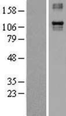Western Blot: Integrin alpha 4 Overexpression Lysate (Adult Normal) [NBL1-12064] Left-Empty vector transfected control cell lysate (HEK293 cell lysate); Right -Over-expression Lysate for Integrin alpha 4.