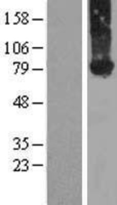 Western Blot: Kindlin-2 Overexpression Lysate (Adult Normal) [NBL1-10677] Left-Empty vector transfected control cell lysate (HEK293 cell lysate); Right -Over-expression Lysate for Kindlin-2.