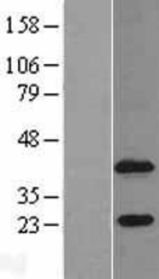 Western Blot: Agpat4 Overexpression Lysate (Adult Normal) [NBL1-07385] Left-Empty vector transfected control cell lysate (HEK293 cell lysate); Right -Over-expression Lysate for Agpat4.