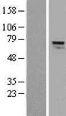 Western Blot: AGPS Overexpression Lysate (Adult Normal) [NBL1-07389] Left-Empty vector transfected control cell lysate (HEK293 cell lysate); Right -Over-expression Lysate for AGPS.