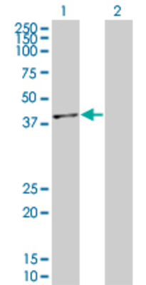 Lane 1: MAPK14 transfected lysate (41.3 KDa). Lane 2: Non-transfected lysate.