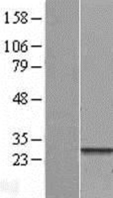 Western Blot: FNDC4 Overexpression Lysate (Adult Normal) [NBL1-10786] Left-Empty vector transfected control cell lysate (HEK293 cell lysate); Right -Over-expression Lysate for FNDC4.