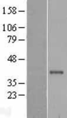 Western Blot: Cathepsin S Overexpression Lysate (Adult Normal) [NBL1-09598] Left-Empty vector transfected control cell lysate (HEK293 cell lysate); Right -Over-expression Lysate for Cathepsin S.