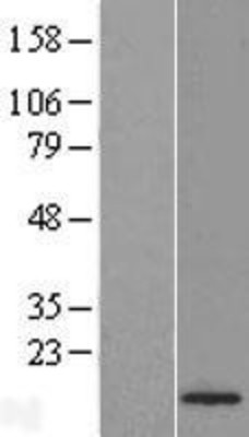 Western Blot: CENPA Overexpression Lysate (Adult Normal) [NBL1-09082] Left-Empty vector transfected control cell lysate (HEK293 cell lysate); Right -Over-expression Lysate for CENPA.