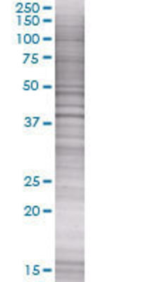 MAPK14 transfected lysate