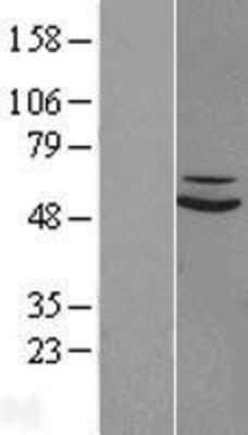 Western Blot: SUOX Overexpression Lysate (Adult Normal) [NBL1-16615] Left-Empty vector transfected control cell lysate (HEK293 cell lysate); Right -Over-expression Lysate for SUOX.