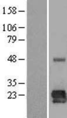 Western Blot: LOH12CR1 Overexpression Lysate (Adult Normal) [NBL1-12637] Left-Empty vector transfected control cell lysate (HEK293 cell lysate); Right -Over-expression Lysate for LOH12CR1.