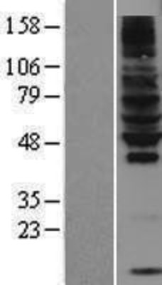 Western Blot: RNF130 Overexpression Lysate (Adult Normal) [NBL1-15421] Left-Empty vector transfected control cell lysate (HEK293 cell lysate); Right -Over-expression Lysate for RNF130.