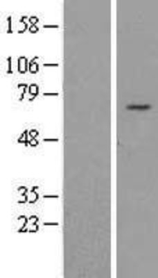 Western Blot: REPIN1 Overexpression Lysate (Adult Normal) [NBL1-15281] Left-Empty vector transfected control cell lysate (HEK293 cell lysate); Right -Over-expression Lysate for REPIN1.