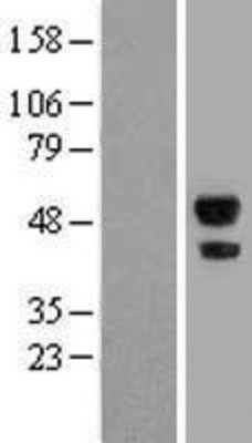 Western Blot: ABHD2 Overexpression Lysate (Adult Normal) [NBL1-07196] Left-Empty vector transfected control cell lysate (HEK293 cell lysate); Right -Over-expression Lysate for ABHD2.
