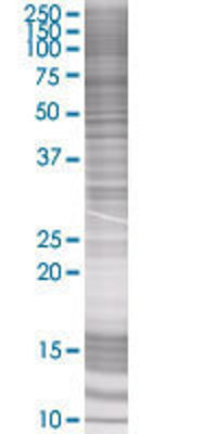 CRABP2 transfected lysate.