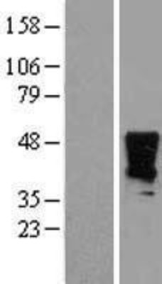Western Blot: HOXA2 Overexpression Lysate (Adult Normal) [NBL1-11666] Left-Empty vector transfected control cell lysate (HEK293 cell lysate); Right -Over-expression Lysate for HOXA2.