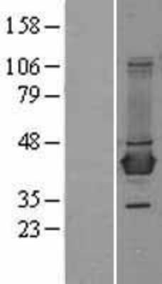 Western Blot: BCAT1 Overexpression Lysate (Adult Normal) [NBL1-07938] Left-Empty vector transfected control cell lysate (HEK293 cell lysate); Right -Over-expression Lysate for BCAT1.