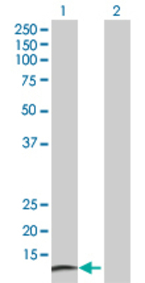Lane 1: CRABP2 transfected lysate (15.7 KDa) Lane 2: Non-transfected lysate.