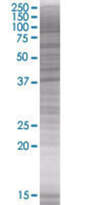 XAB1 transfected lysate.