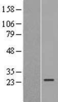 Western Blot: ISOC2 Overexpression Lysate (Adult Normal) [NBL1-12054] Left-Empty vector transfected control cell lysate (HEK293 cell lysate); Right -Over-expression Lysate for ISOC2.