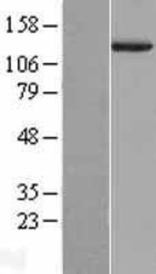 Western Blot: Entactin Overexpression Lysate (Adult Normal) [NBL1-13641] Left-Empty vector transfected control cell lysate (HEK293 cell lysate); Right -Over-expression Lysate for Entactin.