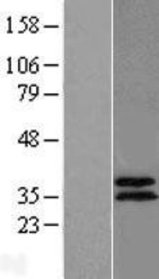 Western Blot: ABHD11 Overexpression Lysate (Adult Normal) [NBL1-07190] Left-Empty vector transfected control cell lysate (HEK293 cell lysate); Right -Over-expression Lysate for ABHD11.