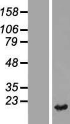 Western Blot: TXNDC12 Overexpression Lysate (Adult Normal) [NBL1-17465] Left-Empty vector transfected control cell lysate (HEK293 cell lysate); Right -Over-expression Lysate for TXNDC12.