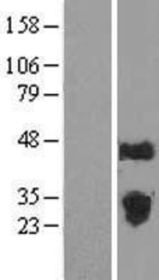 Western Blot: FAM3C Overexpression Lysate (Adult Normal) [NBL1-10524] Left-Empty vector transfected control cell lysate (HEK293 cell lysate); Right -Over-expression Lysate for FAM3C.
