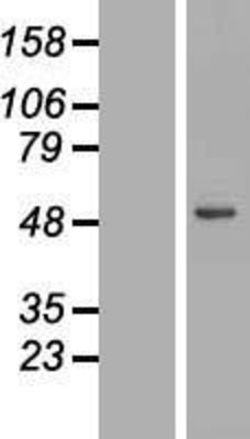 Western Blot: Lipase A Overexpression Lysate (Adult Normal) [NBL1-12546] Left-Empty vector transfected control cell lysate (HEK293 cell lysate); Right -Over-expression Lysate for Lipase A.