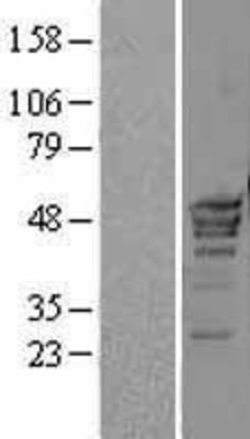 Western Blot: POLR3D Overexpression Lysate (Adult Normal) [NBL1-14592] Left-Empty vector transfected control cell lysate (HEK293 cell lysate); Right -Over-expression Lysate for POLR3D.