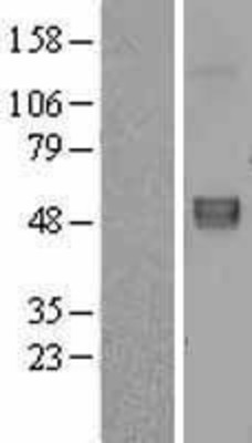 Western Blot: Fibulin 5 Overexpression Lysate (Adult Normal) [NBL1-10609] Left-Empty vector transfected control cell lysate (HEK293 cell lysate); Right -Over-expression Lysate for Fibulin 5.