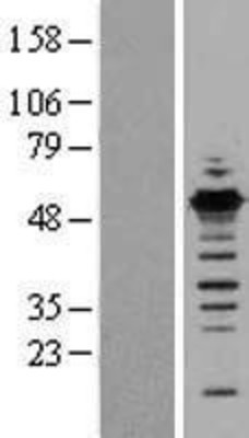 Western Blot: GABPB1 Overexpression Lysate (Adult Normal) [NBL1-10912] Left-Empty vector transfected control cell lysate (HEK293 cell lysate); Right -Over-expression Lysate for GABPB1.
