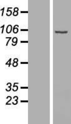 Western Blot: DIEXF Overexpression Lysate (Adult Normal) [NBL1-08291] Left-Empty vector transfected control cell lysate (HEK293 cell lysate); Right -Over-expression Lysate for DIEXF.