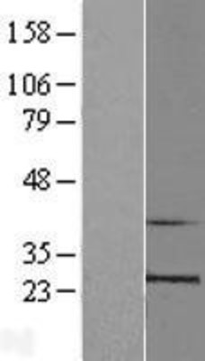 Western Blot: RPL10 Overexpression Lysate (Adult Normal) [NBL1-15499] Left-Empty vector transfected control cell lysate (HEK293 cell lysate); Right -Over-expression Lysate for RPL10.