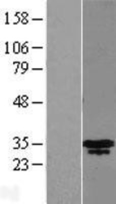 Western Blot: MLX Overexpression Lysate (Adult Normal) [NBL1-13141] Left-Empty vector transfected control cell lysate (HEK293 cell lysate); Right -Over-expression Lysate for MLX.