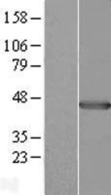 Western Blot: Pleckstrin Overexpression Lysate (Adult Normal) [NBL1-14499] Left-Empty vector transfected control cell lysate (HEK293 cell lysate); Right -Over-expression Lysate for Pleckstrin.
