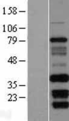 Western Blot: FAM92B Overexpression Lysate (Adult Normal) [NBL1-10582] Left-Empty vector transfected control cell lysate (HEK293 cell lysate); Right -Over-expression Lysate for FAM92B.