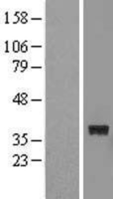 Western Blot: FTSJ1 Overexpression Lysate (Adult Normal) [NBL1-10853] Left-Empty vector transfected control cell lysate (HEK293 cell lysate); Right -Over-expression Lysate for FTSJ1.