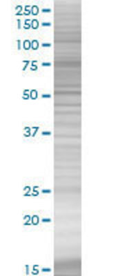 DSU transfected lysate.