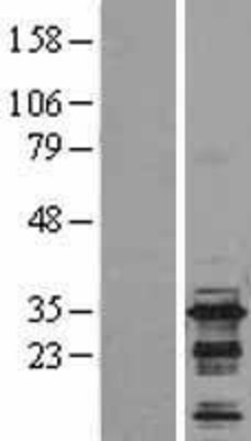 Western Blot: BIN3 Overexpression Lysate (Adult Normal) [NBL1-07983] Left-Empty vector transfected control cell lysate (HEK293 cell lysate); Right -Over-expression Lysate for BIN3.