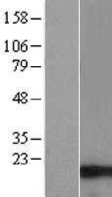 Western Blot: C9orf16 Overexpression Lysate (Adult Normal) [NBL1-08586] Left-Empty vector transfected control cell lysate (HEK293 cell lysate); Right -Over-expression Lysate for C9orf16.