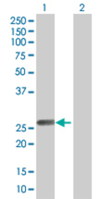 Lane 1: DSU transfected lysate (25 KDa) Lane 2: Non-transfected lysate.