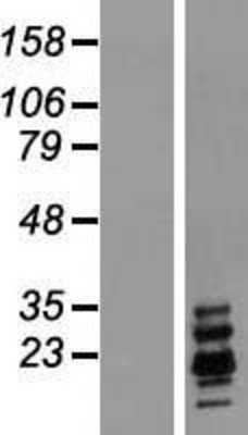 Western Blot: Ribonuclease A Overexpression Lysate (Adult Normal) [NBL1-15392] Left-Empty vector transfected control cell lysate (HEK293 cell lysate); Right -Over-expression Lysate for Ribonuclease A.