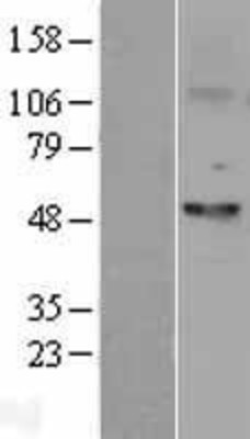 Western Blot: Fascin Overexpression Lysate (Adult Normal) [NBL1-10841] Left-Empty vector transfected control cell lysate (HEK293 cell lysate); Right -Over-expression Lysate for Fascin.