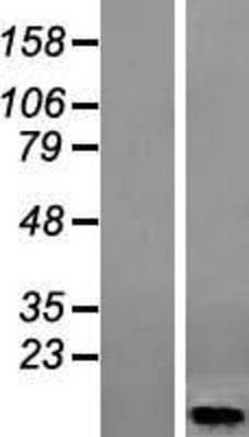 Western Blot: HIGD1A Overexpression Lysate (Adult Normal) [NBL1-11542] Left-Empty vector transfected control cell lysate (HEK293 cell lysate); Right -Over-expression Lysate for HIGD1A.