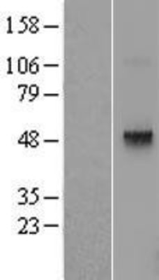 Western Blot: Thyrotropin-Releasing Hormone Receptor Overexpression Lysate (Adult Normal) [NBL1-17269] Left-Empty vector transfected control cell lysate (HEK293 cell lysate); Right -Over-expression Lysate for Thyrotropin-Releasing Hormone Receptor.