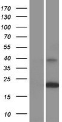 Western Blot: tetraspanin 14 Overexpression Lysate (Adult Normal) [NBP2-11120] Left-Empty vector transfected control cell lysate (HEK293 cell lysate); Right -Over-expression Lysate for tetraspanin 14.