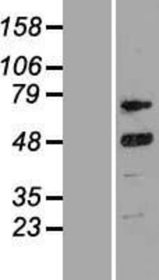 Western Blot: Cyclin T2 Overexpression Lysate (Adult Normal) [NBP2-10962] Left-Empty vector transfected control cell lysate (HEK293 cell lysate); Right -Over-expression Lysate for Cyclin T2.